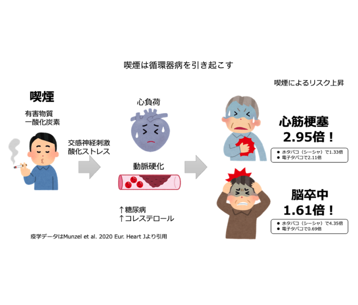 生活習慣に気を配ろう ｜ 一般社団法人 日本循環器協会｜Japanese Circulation Association